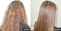 /album/galeria-de-fotos-rejuvenescimento-capilar/antes-e-depois-jpg/